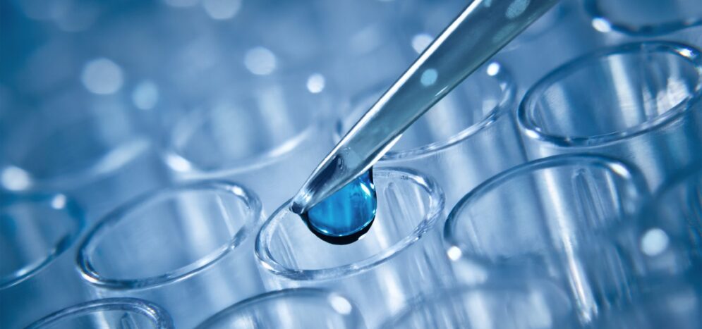 Legionella risk