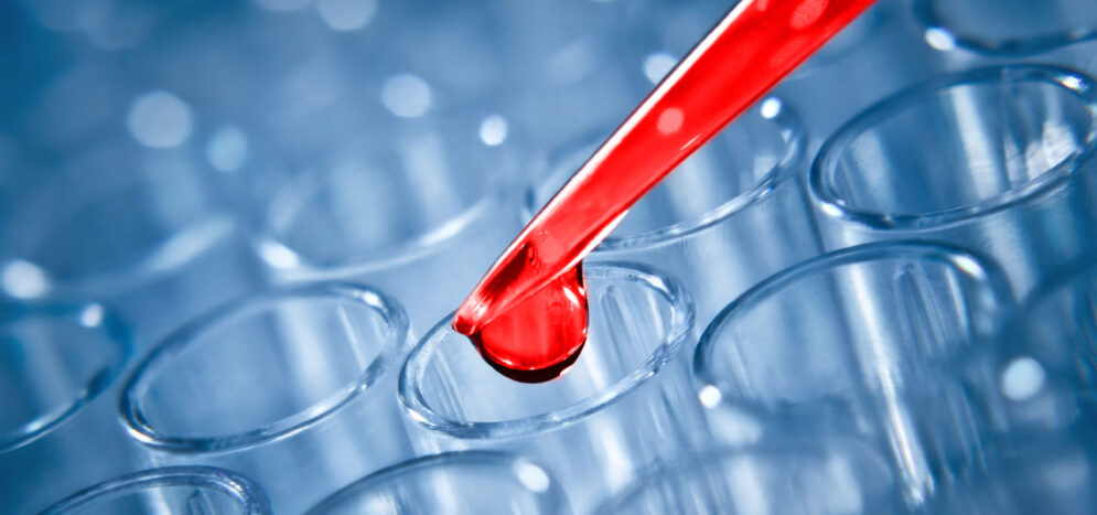 Legionella-risk2 Legionella-risk2